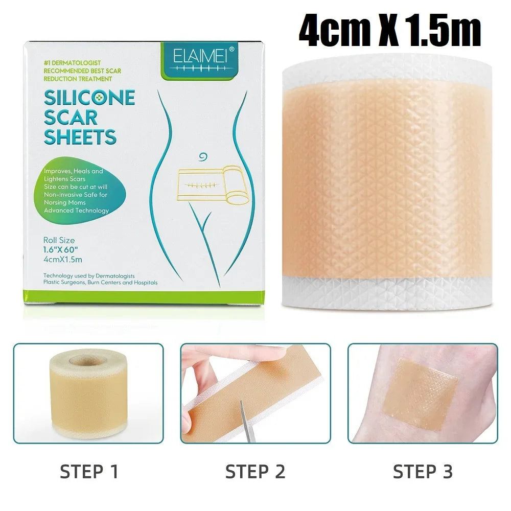 1 Roll / 2 Roll Silicone Scar Sheets, 4cm X 150cm Self-Adhesive Scar Cover Tape Reusable and Effective Skin Care Strips